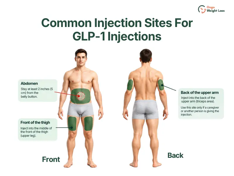Common GLP-1 injection sites: abdomen, front of the thigh, and back of the upper arm