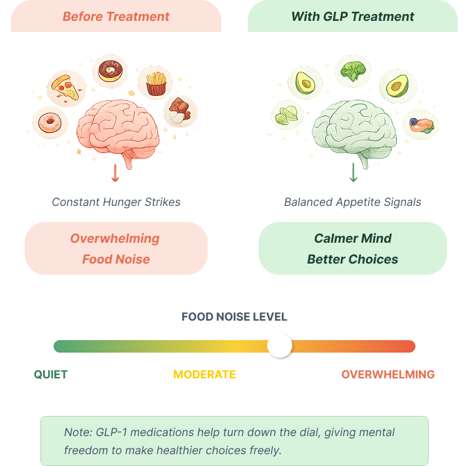Before treatment versus with GLP treatment — food noise comparison