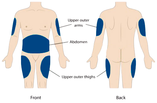 wegovy (1) Where to Inject Ozempic Image