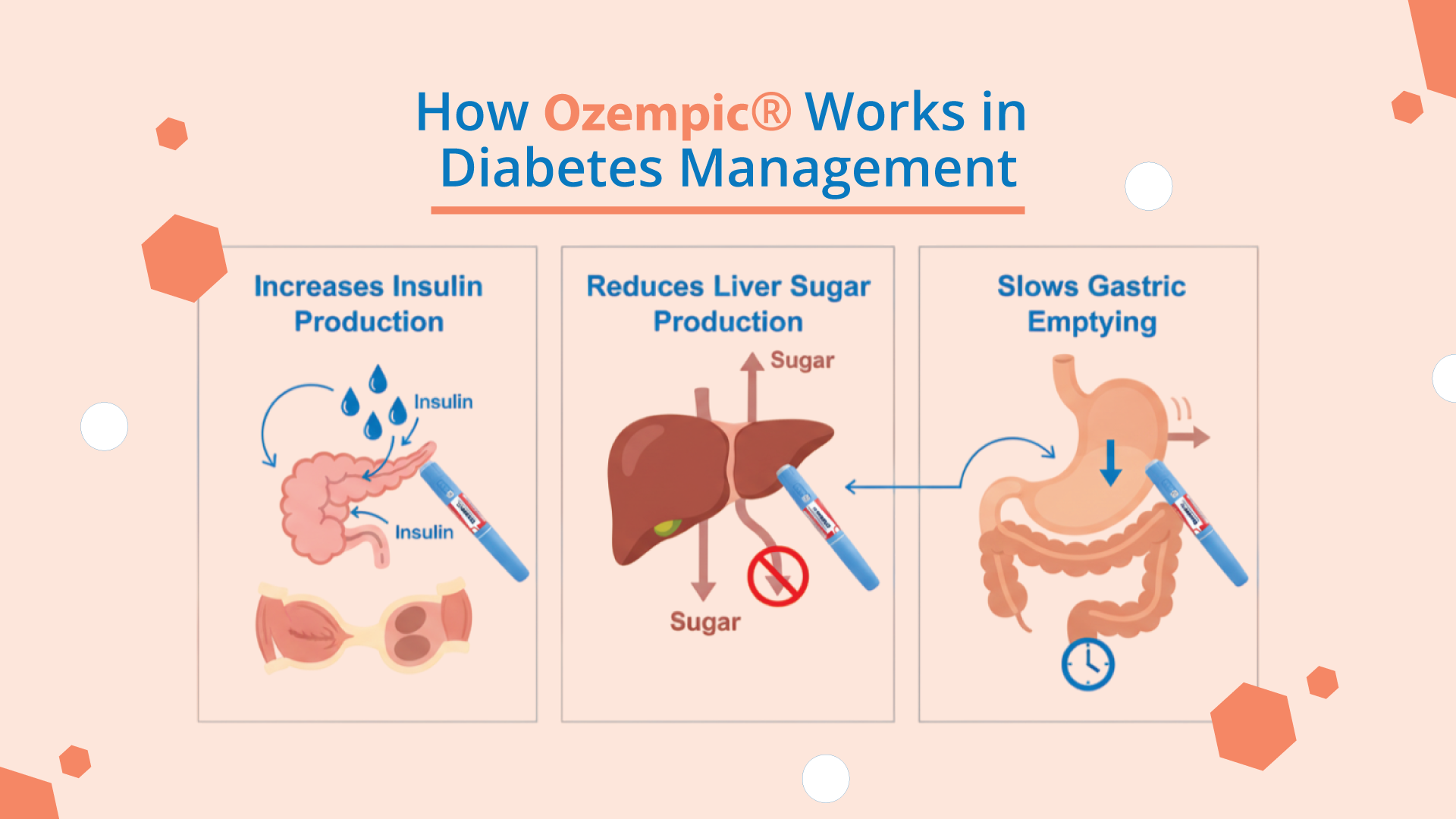 How Ozempic works in diabetes management
